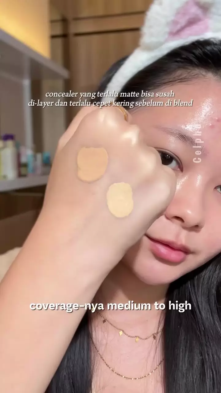 Concealer malah bikin bekas jerawat makin © Instagram  Concealer malah bikin bekas jerawat makin © Instagram
