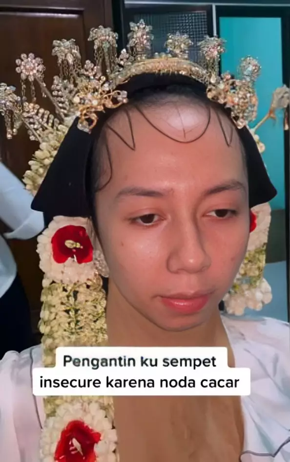 Transformasi makeup pengantin dengan bekas cacar ini bikin takjub © 2025 berbagai sumber