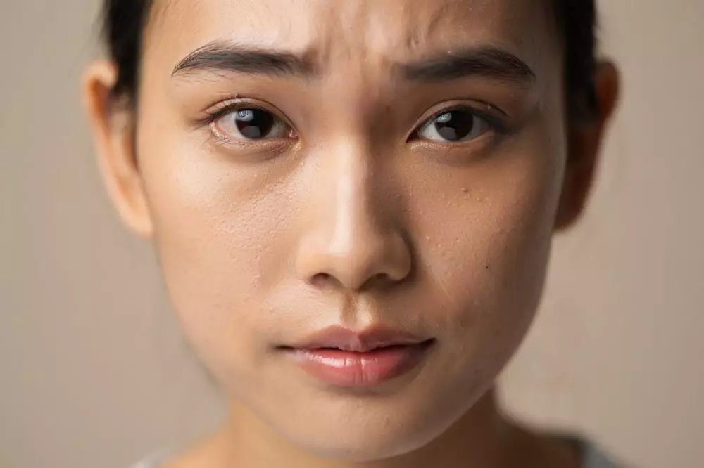 Sudah skincare-an tapi masih kusam © 2025 brilio.net