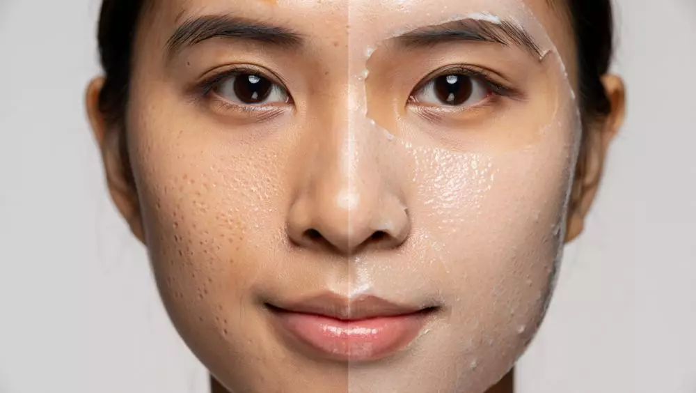 5 rahasia mengecilkan pori-pori wajah secara alam © 2025 brilio.net