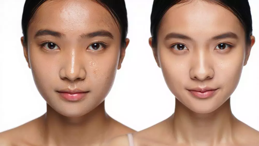 Kesalahan skincare yang bikin wajah makin berminyak © 2025 brilio.net