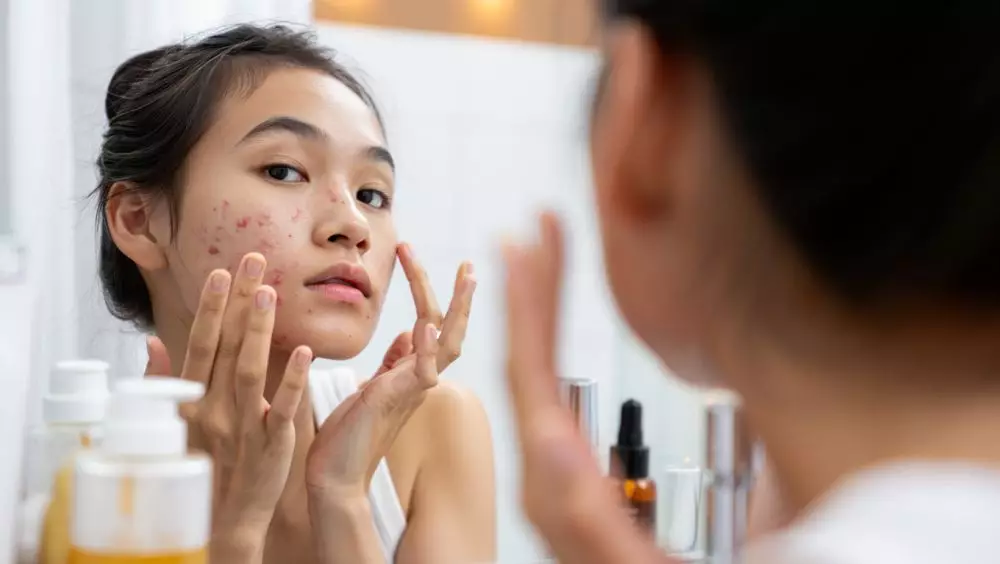 Cara menghilangkan jerawat dengan cepat dan aman © 2025 brilio.net Cara menghilangkan jerawat dengan cepat dan aman © 2025 brilio.net