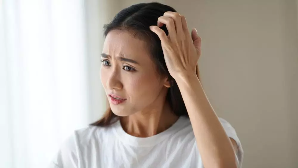 Cara ampuh menghilangkan ketombe membandel © 2025 brilio.net