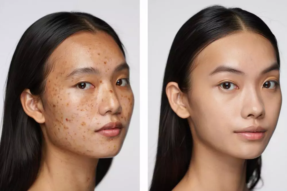 Kesalahan perawatan wajah yang diam-diam merusak skin barrier © 2025 brilio.net Kesalahan perawatan wajah yang diam-diam merusak skin barrier © 2025 brilio.net