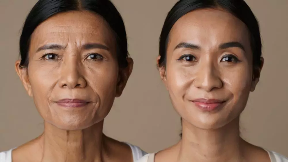 Kerutan memudar dalam 2 minggu © 2025 brilio.net Kerutan memudar dalam 2 minggu © 2025 brilio.net