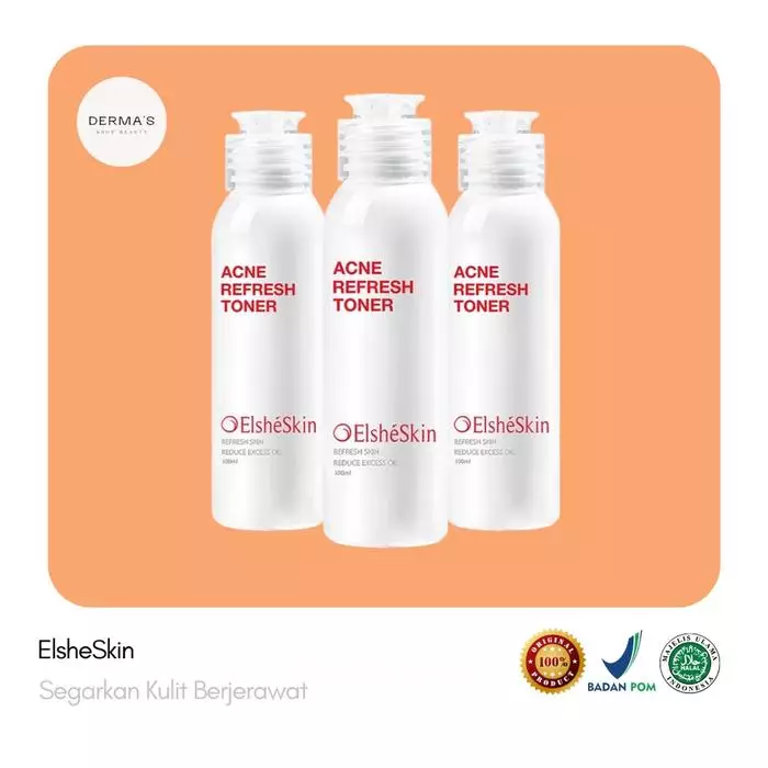 10 Toner menghilangkan jerawat harga di bawah Rp 200 ribu © 2025 brilio.net