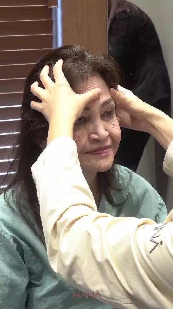 ibunda Nia Ramadhani oplas © Instagram