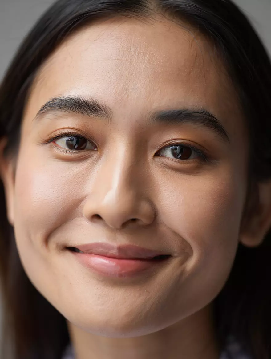 Cara mengurangi smile line tanpa operasi © 2025 brilio.net